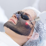 Carbon Facial